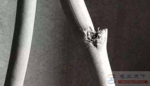 ���е�բ����բ���²�ͷ������բ��ʲôԭ��