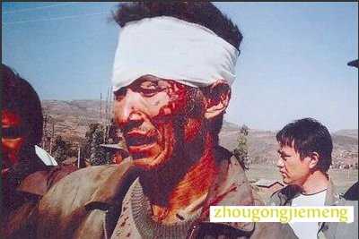 �μ���Ѫ ��Ѫ