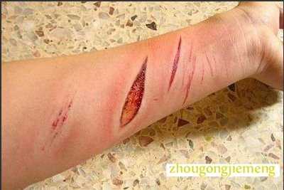 �μ�����